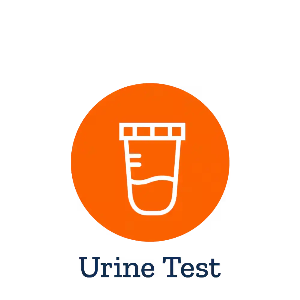 Catecholamines (Fractionated) 24-hour Urine Test