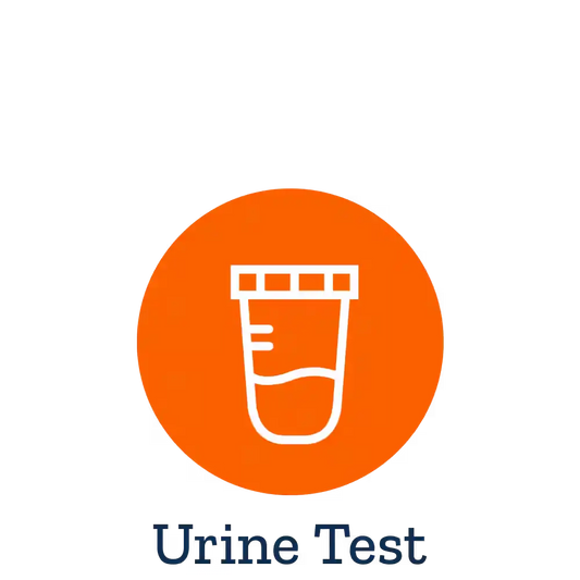 Urinalysis Urine Test